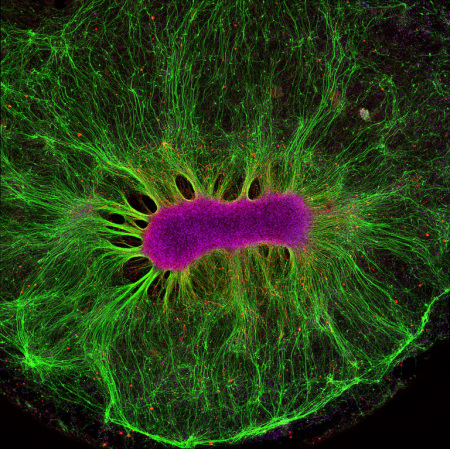 This could lead to loss of brain cells in old age