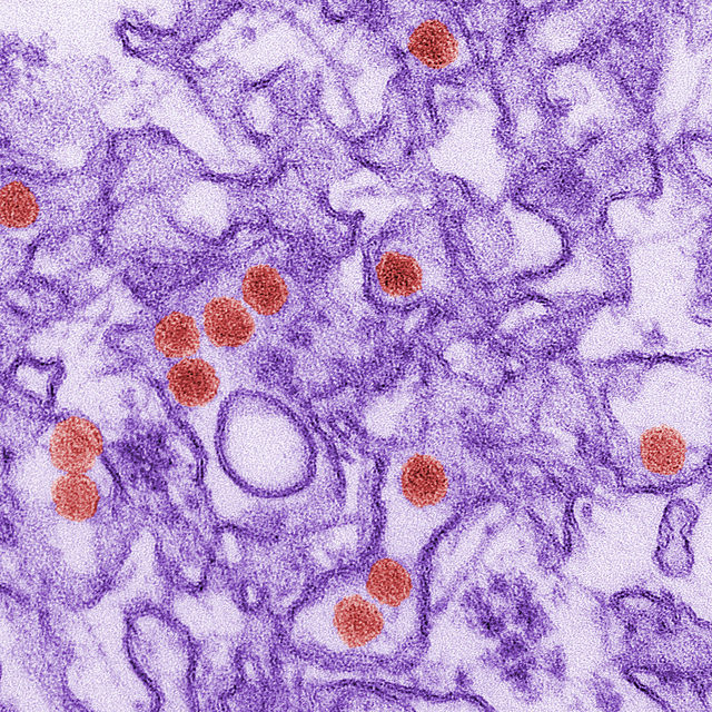 Here’s how Zika virus strips immune cells of their identity