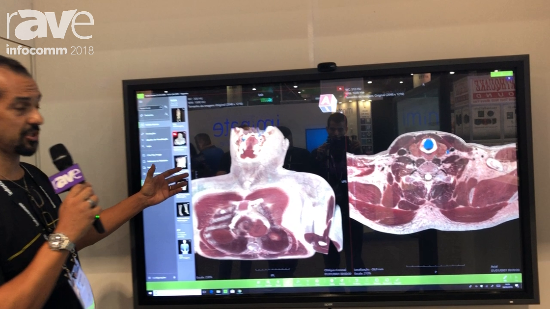 InfoComm 2018: Apek International Demos 3D Body Imaging Solution for Hospitals And Education