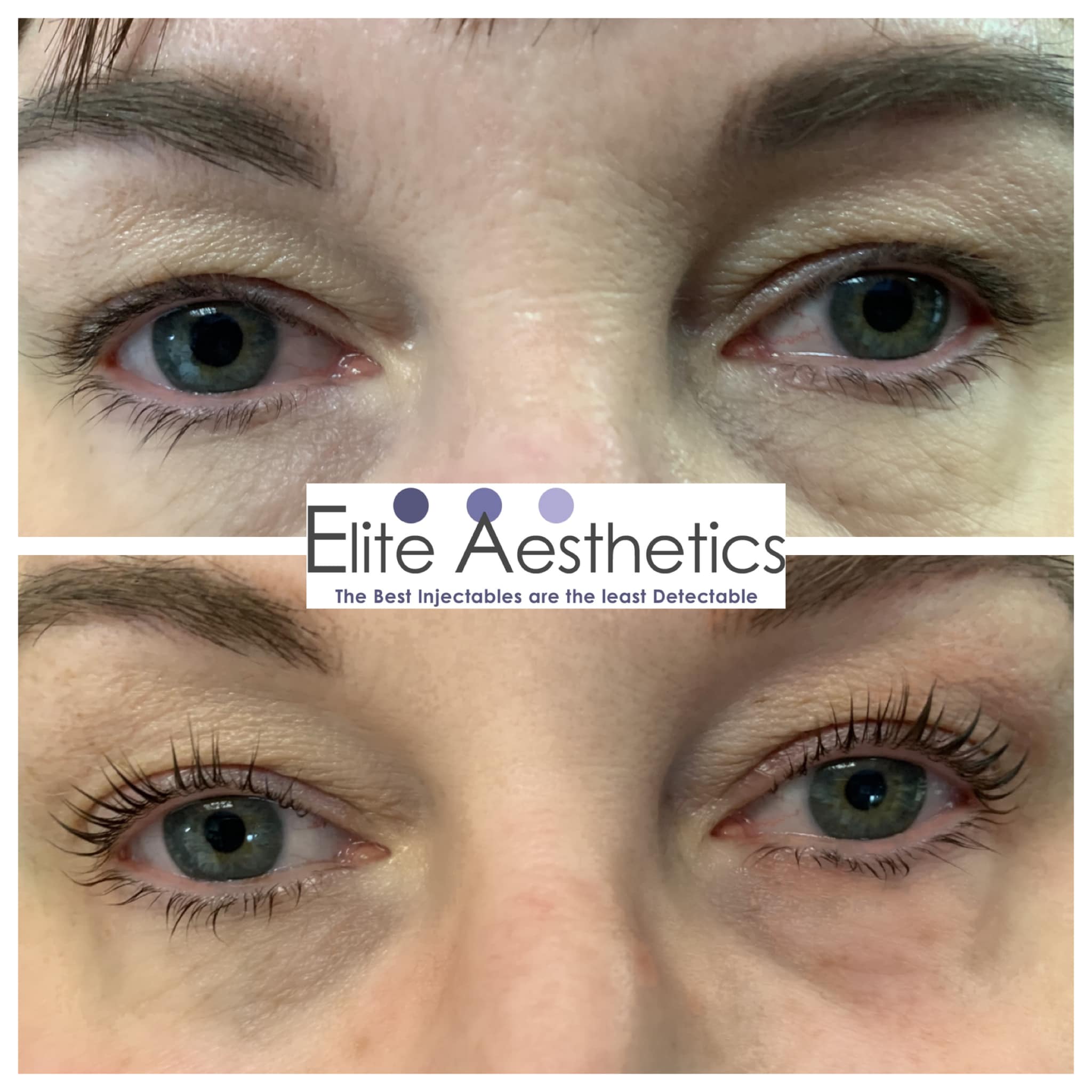 What happens in a couple spa?