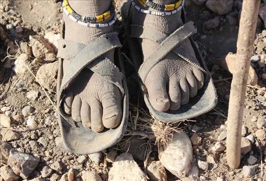 The weathered feet of of a Masai girl. This photo represents the harsh reality of nomadic life.