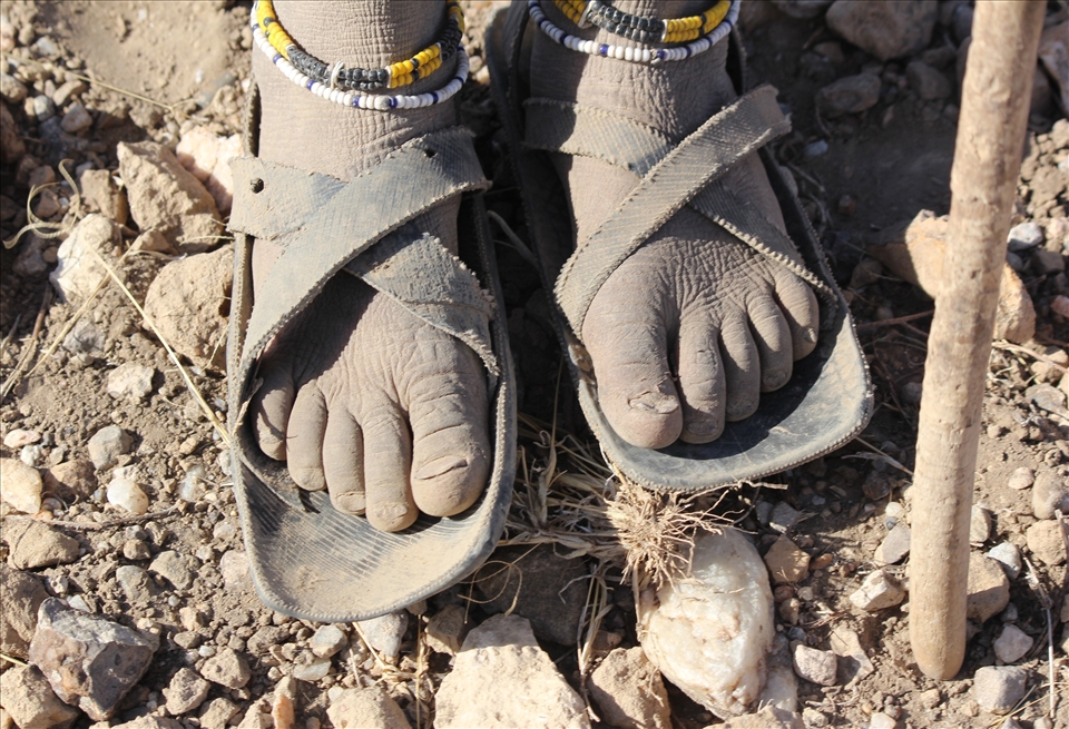 The weathered feet of of a Masai girl. This photo represents the harsh reality of nomadic life.