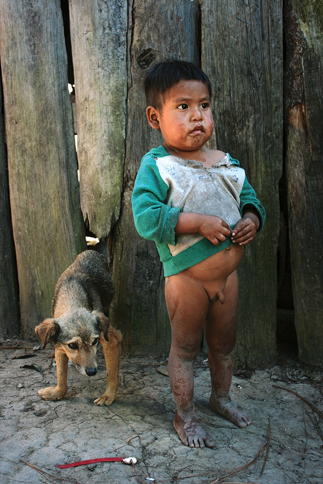 Hungry Childhood

Famine is almost present on every child in town. Malnutrition is the first cause of dead in Cochoapan. Even in dogs malnutrition is present.
