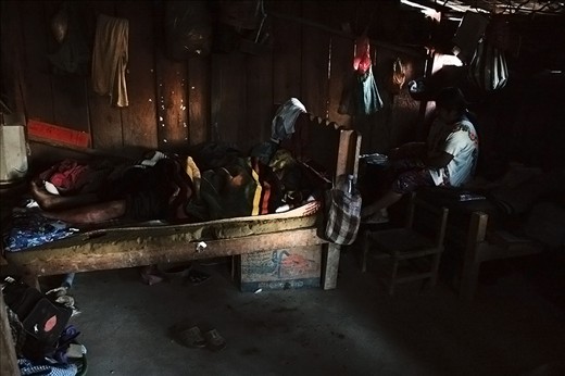 Waiting for death.

This man, 22 yo, refuses to receive medical attention. He scratch his leg with a small rock while working, but since they believe that the local clinic is where people go to die, he prefers to stay at home and wait for dead. He is father of three small children.