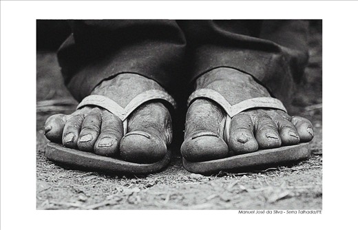 Coffee Feet - Works in the coffee harvest twenty-two years(Manoel José da Silva)