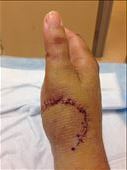 One of the many scars on my right hand: by drfrenchie, Views[333]