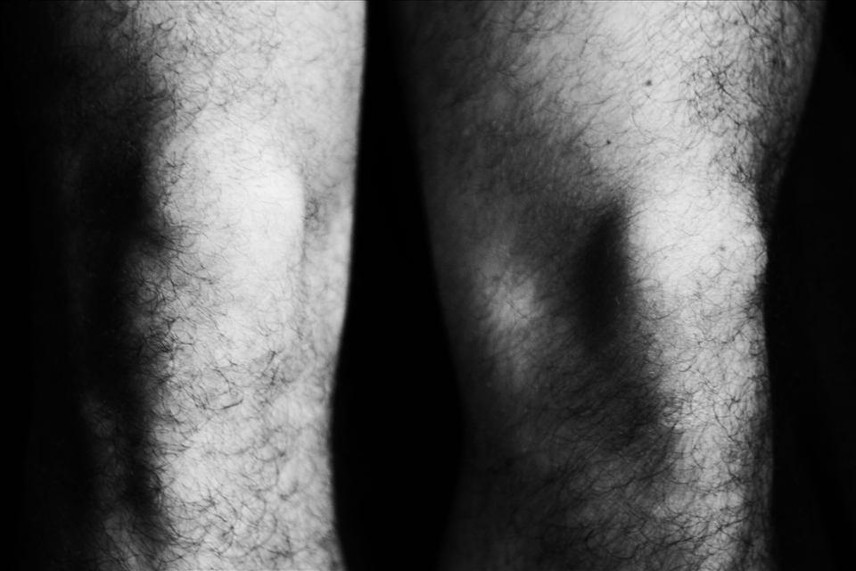 Psychological paralysis