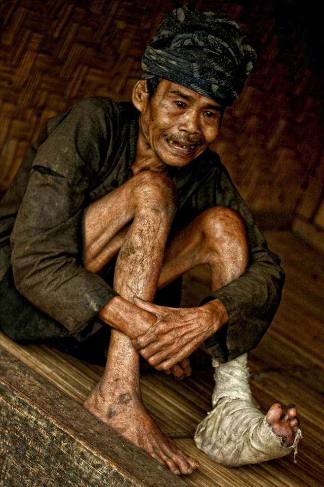 There is no doctor, they just use natural herbs for treatment.