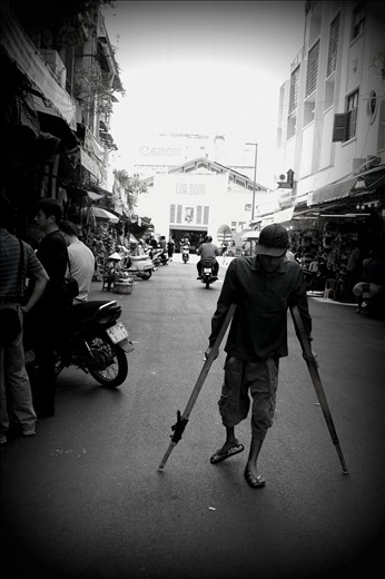 Cannot afford a wheel chair, the man still manages to stand on his feet
