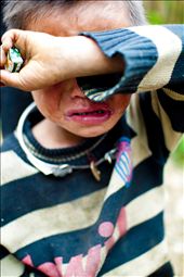 This boy ran so fast, he tripped and got his toe nail flipped. I put on bandage for the poor kid and gave him a candy to make him feel better. He still cried so much while holding on tight to his candy. : by huongle, Views[828]