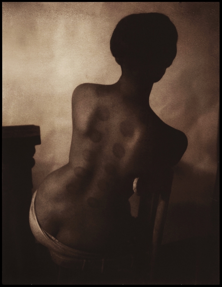 The last photograph is a departing picture. One I took just before I left. Her name is Natalie, and she was a bit of a wonderer, a displaced soul, who I'd eventually come to know quite well. We ended up living together and exchanging and making many experiences. She'd come home one day, with these markings on her back after getting Chinese suction therapy, and I immediately photographed the wonderful impressions. Polaroid 350 -  Chocolate 100