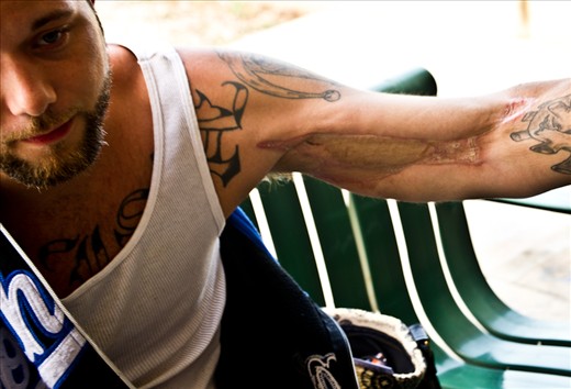 On his first day a new resident shows a scar from a high that hospitalized and nearly killed him a few days prior.