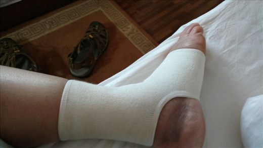 Bum ankle 😝 but still finishing the build 🙆