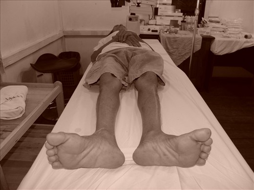 Operating tables are constructed out of office desks. Hand woven mats lie on top and a white linin is thrown over the surface. Bapak Arnji calmly waits while Dr. Steve prepares for surgery.  “The first thing I want to do is kiss my wife. I haven’t been able to see her face. All I’ve been able to do is hear her voice.” – Bapak Arnji  