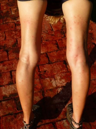 .....and I got eaten up....