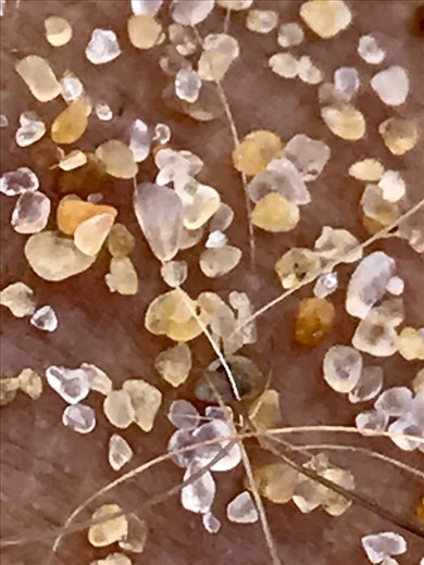 Beach sand on my hairy legs!