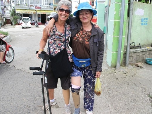 She greeted me with curiosty and enthusiasm to compare prostheses, Dalat