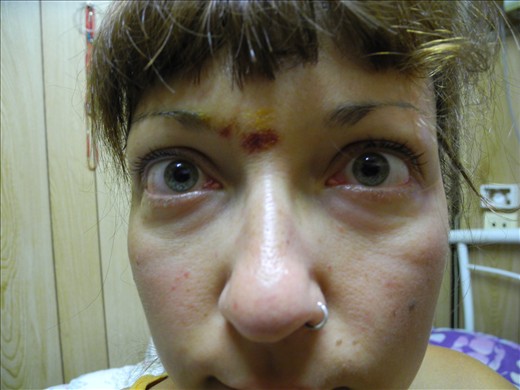 the third eye. brought to you by Mango Sap.