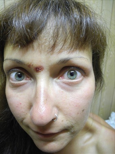 third eye healing. NOT!