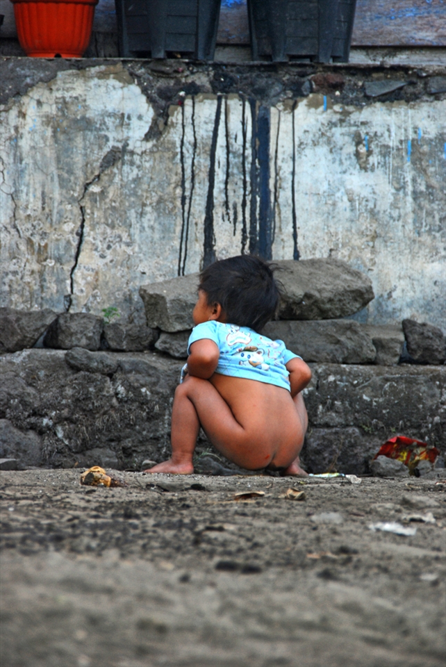 Activity pooping Belandingan villagers, Kintamani, Bali is still far from healthy. Here the dry soil conditions and lack of water makes them throw their feces directly into the soil in the garden behind the house. They make holes that are not deep enough, after removing dirt, the hole is covered with sandy soil.