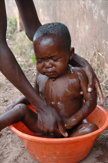 Bathing in cold water to reduce malaria induced fever