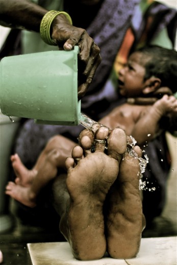 They use it to uncontract the fetal position and offer them a good rest.