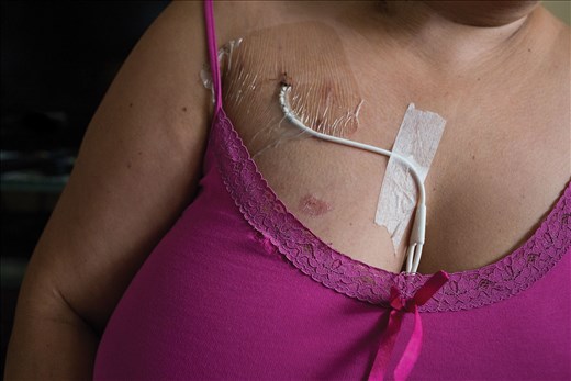 Nurses clean this woman's  