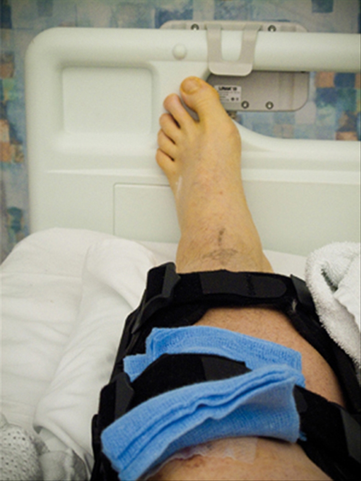 Operation 1: What one human can do to another