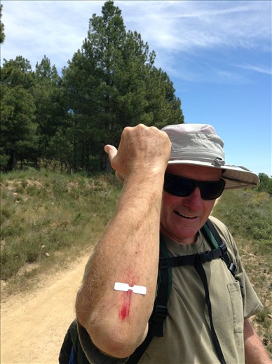 my hiking pole tripped me