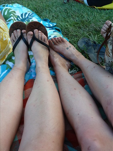 Guess who forgot to wear pants while cutting the Queen Anne's Lace