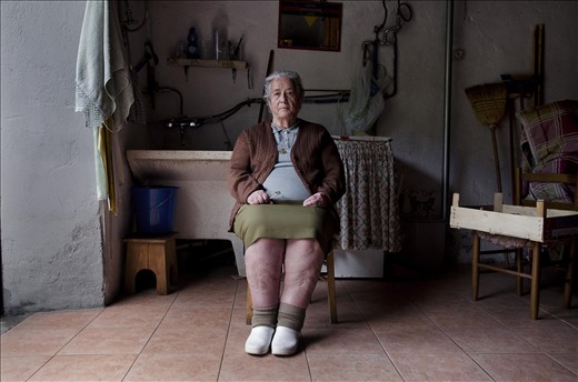 Andreina is 80 years old and lives in Fabbriche di Vallico; even after 40 years she realizes the power she has: she only knows that everything is related to divine providence. She uses hands to cure herpes zoster and evil eye both to humans and animals, mostly cows and horses.
