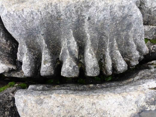 Erm, must book a dental appointment!