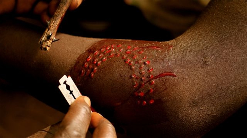 Suri woman undergoing scarification ritual. Kibish, Southern Ethiopia