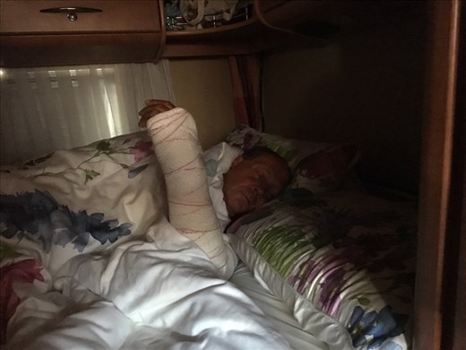 How John sleeps at night with his arm in plaster