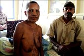 Suare Kande was accused of sorcery, during the 7 day attack she lost 5 fingers and suffered severe burns. Goroka Hospital , Goroka.: by vinnie, Views[373]