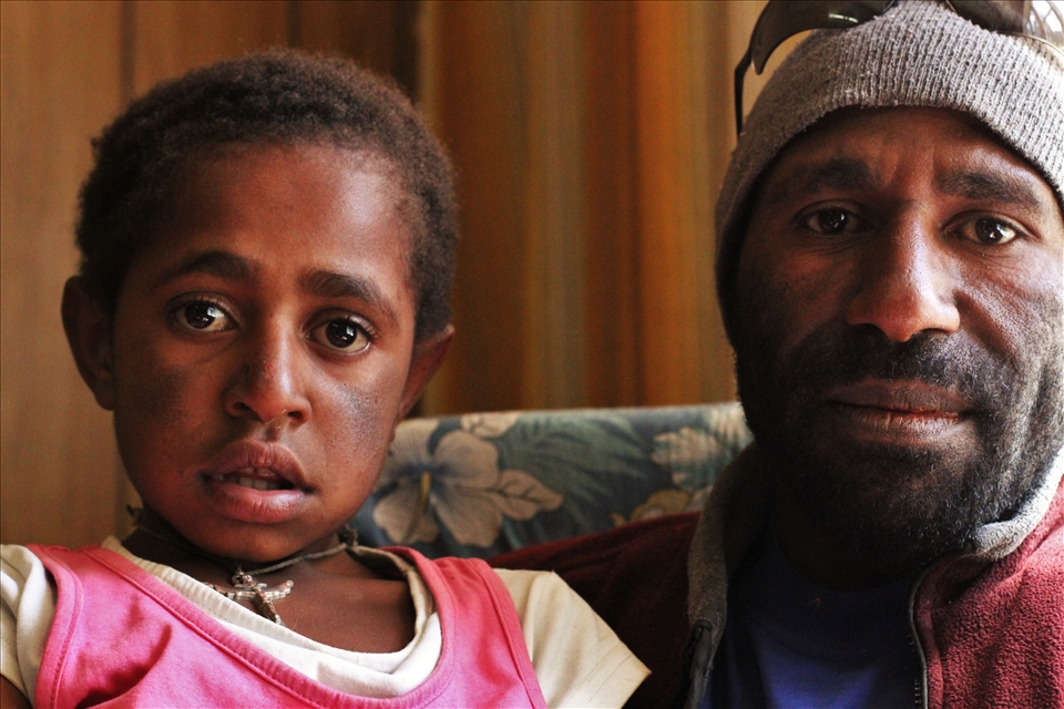 Kathy (9 years old) is a self proclaimed sorceror, Norris (right) helped with her exorcisim. Goglme Parish , Goglme.