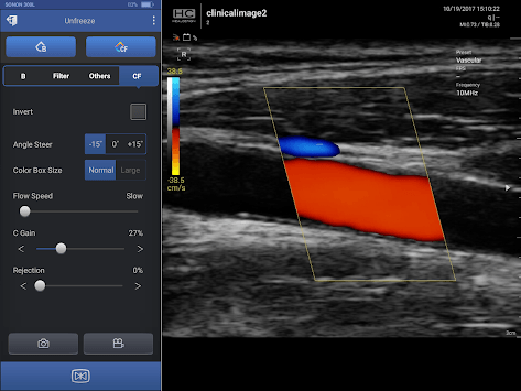 SONON Ultrasound App for PC screenshot 1