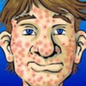 Acne: Cures, Causes & Myths book app Health and Fitness