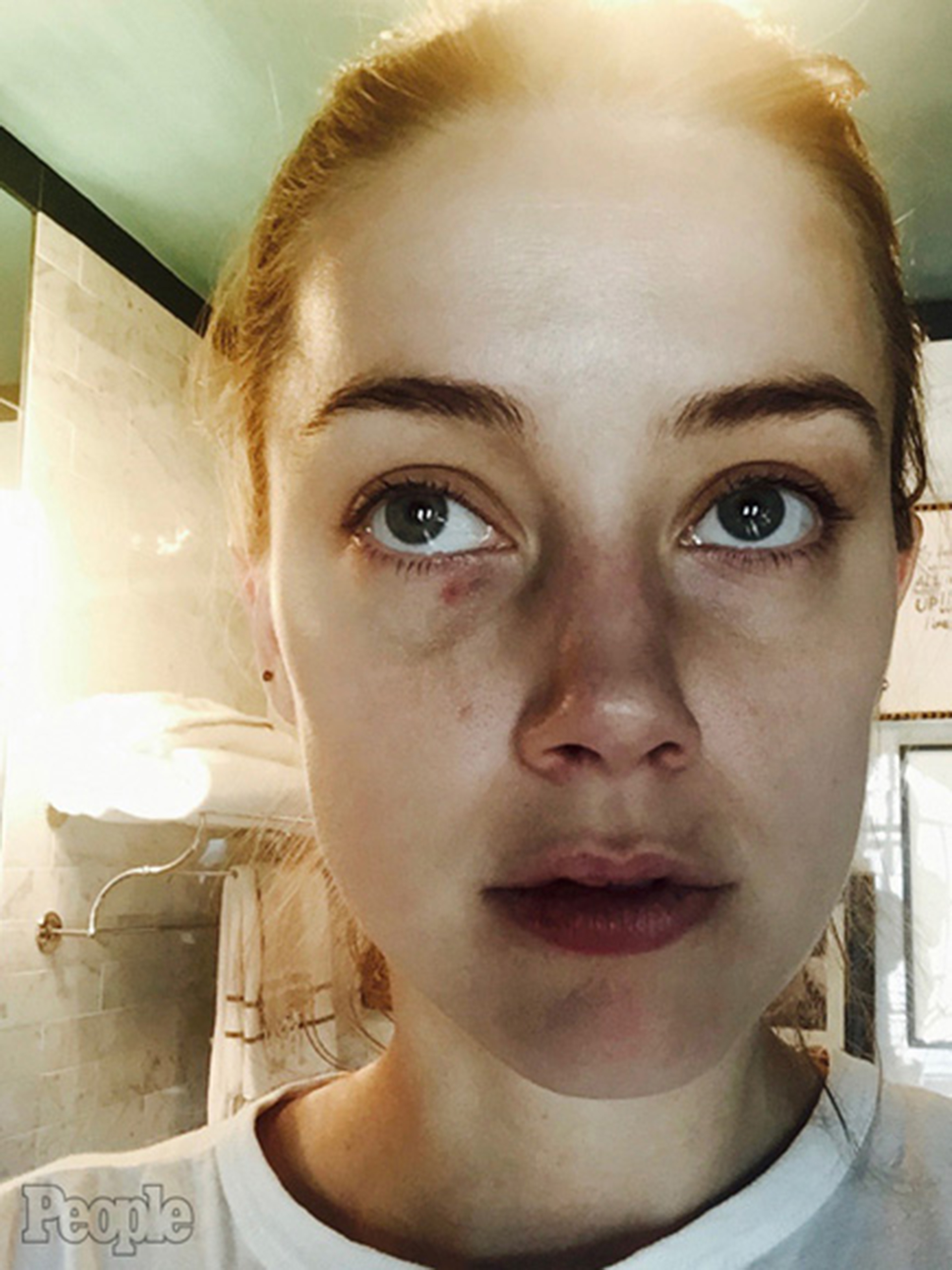 Amber Heard acusó a Johnny Depp de maltrato y mostró su rostro golpeado