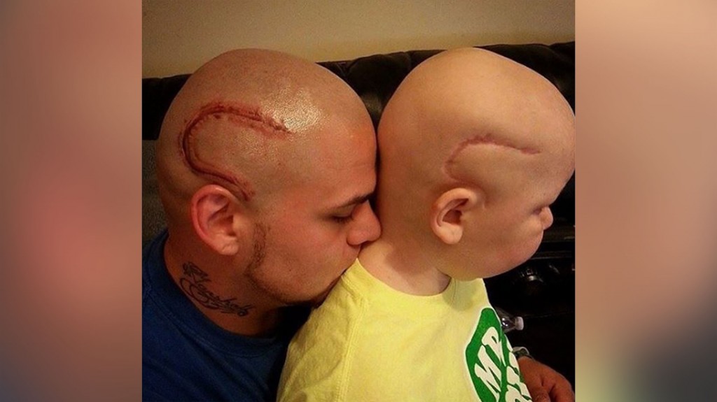 Josh Marshall decidió tatuarse la cicatriz de su hijo Gabriel como señal de amor