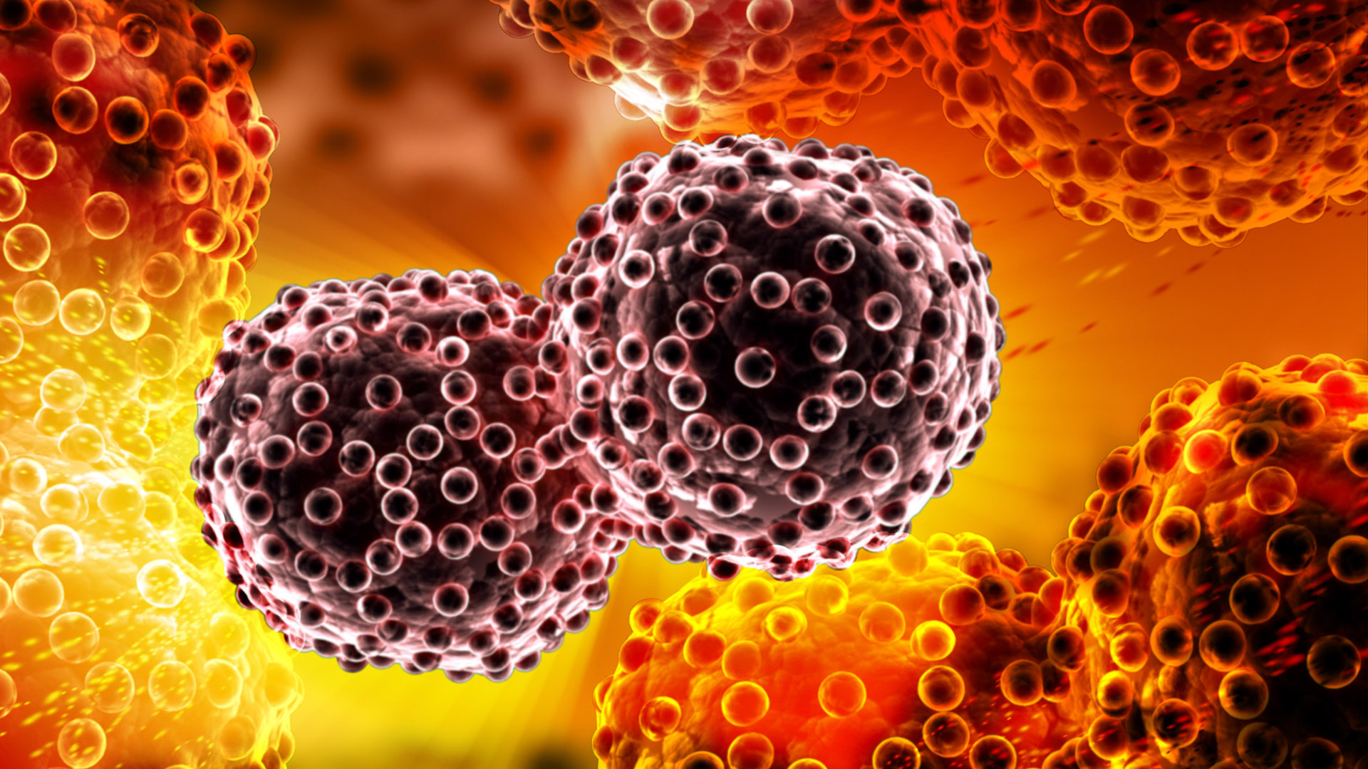 Un tumor alojado en el intestino (Shutterstock)