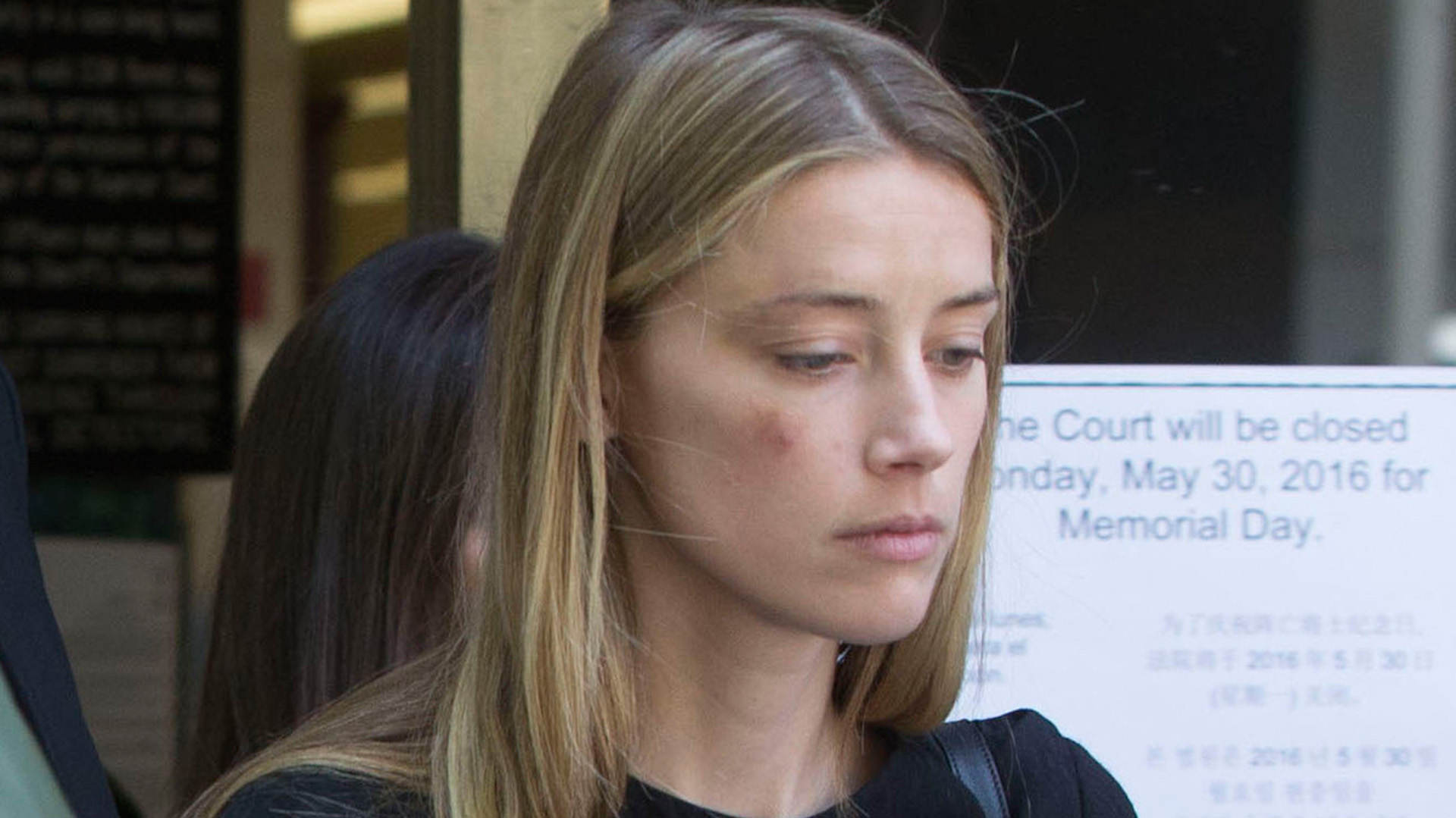 Amber Heard con su rostro golpeado (Grosbygroup)