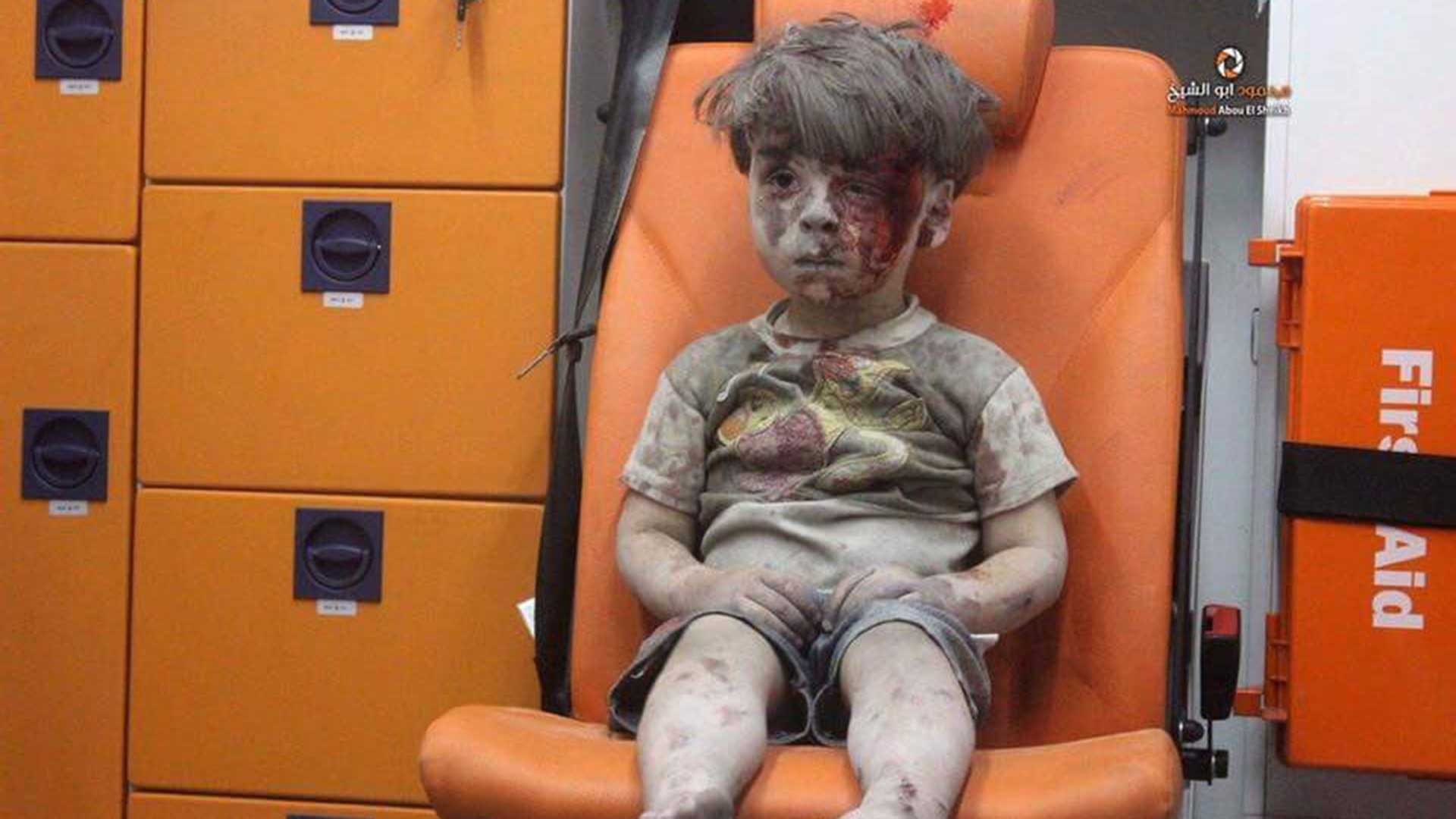 Omran Daqneesh, el niño sirio herido en un ataque aéreo en Alepo, mientras aguarda asistencia médica.