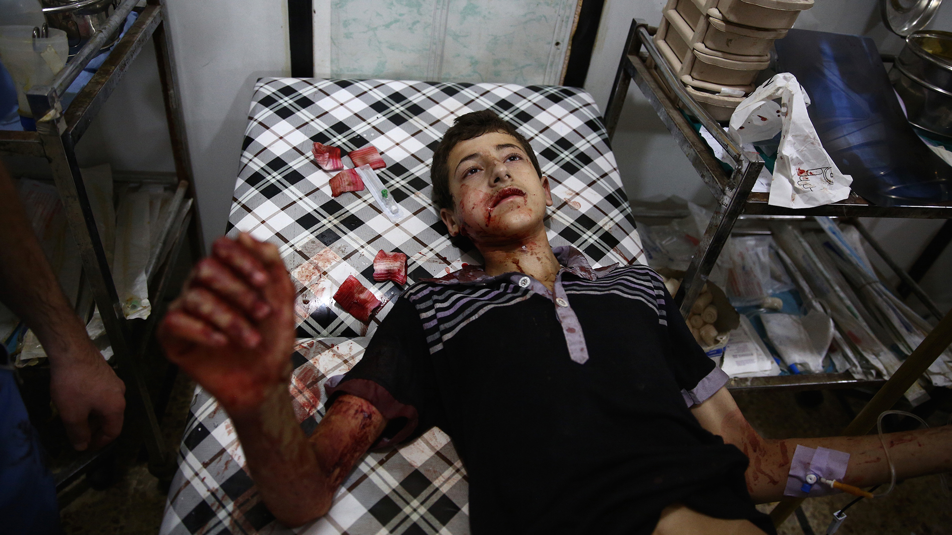 Un joven sirio recibe asistencia médica en Shaffuniya, al este de la capital Damasco (AFP)