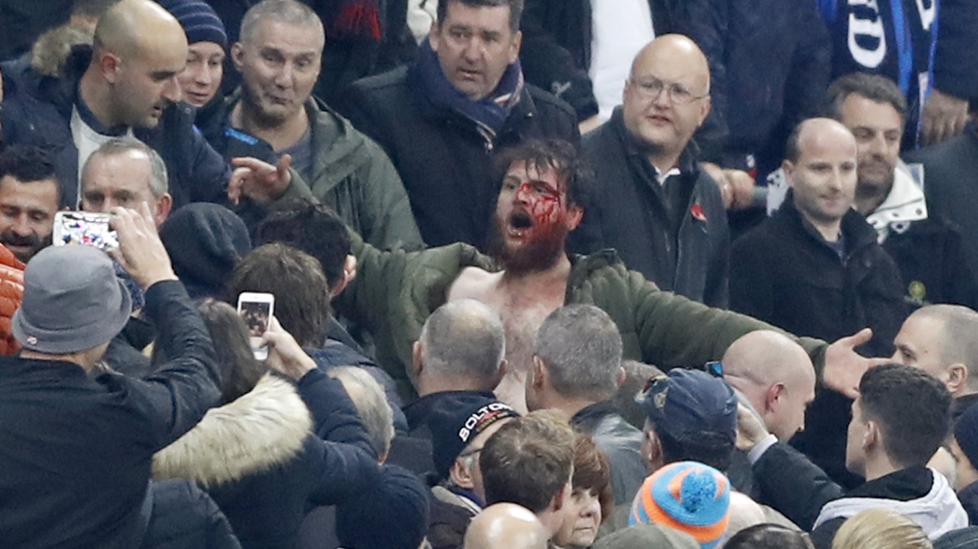 Un hombre con la cara llena de sangre tras recibir una golpiza (Reuters)