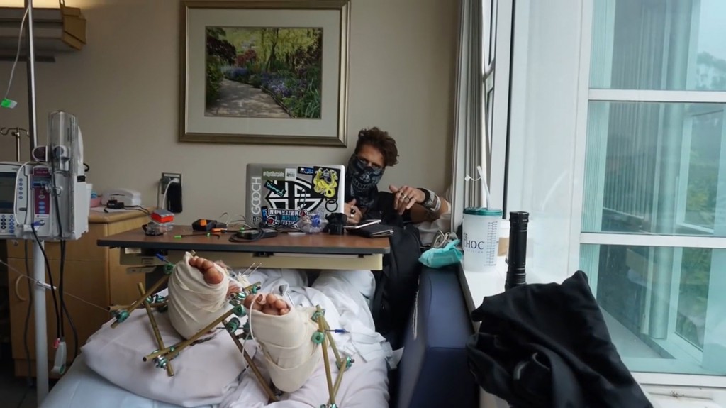 El youtuber 8Booth, famoso por filmarse tirándose al vacío, calculó mal y se fracturó las dos piernas
