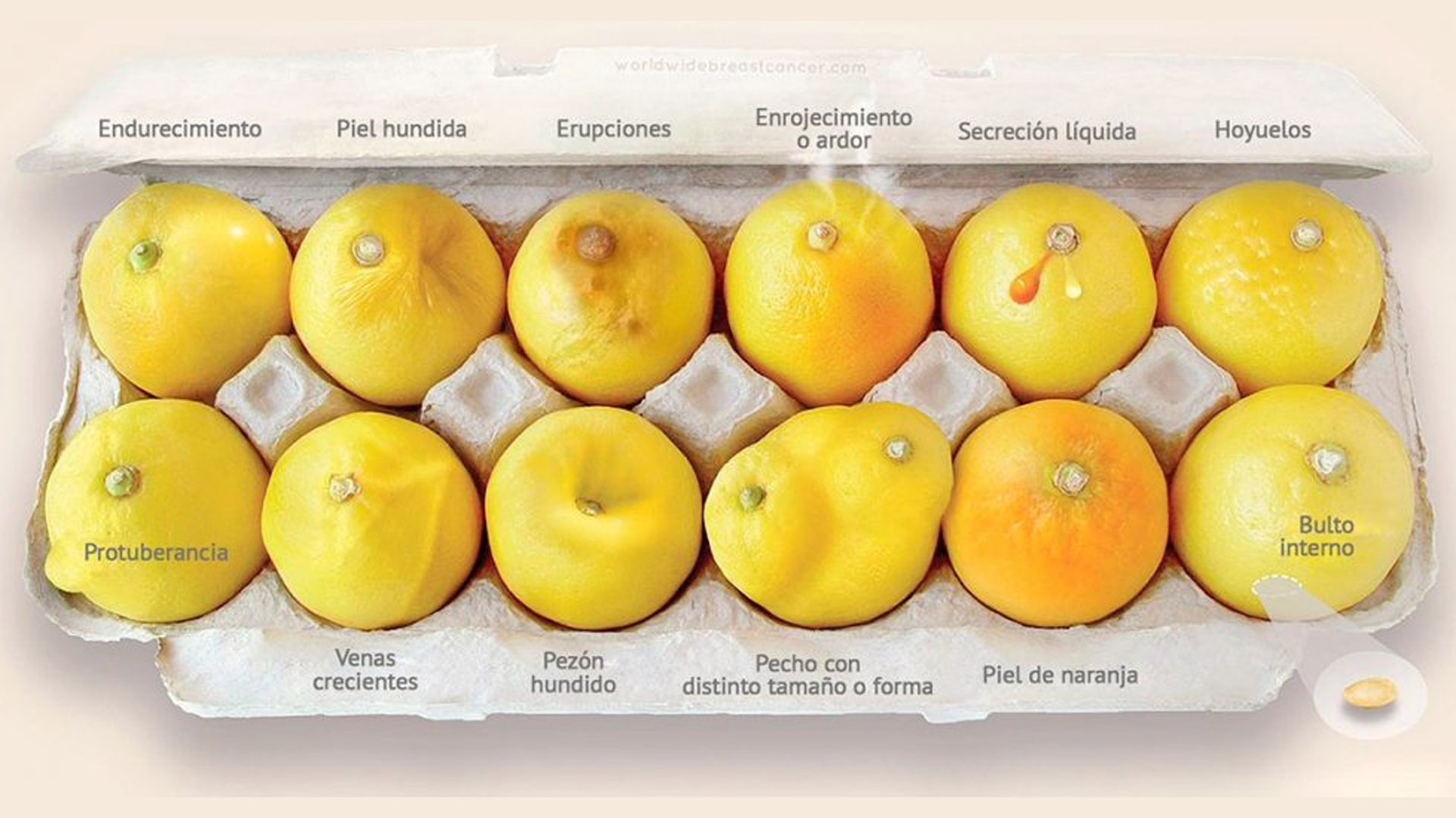 Diversas campañas tratan de concientizar sobre la salud mamaria