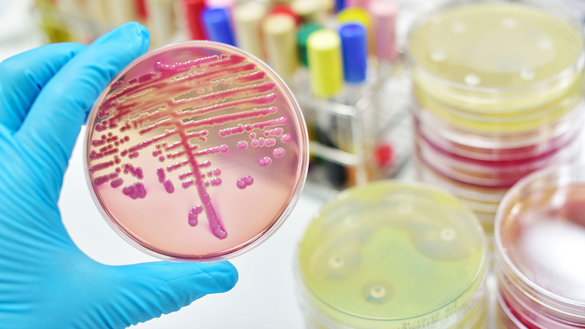 Klebsiella sintomas y tratamiento