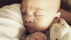 bebe-labio-leporino-4