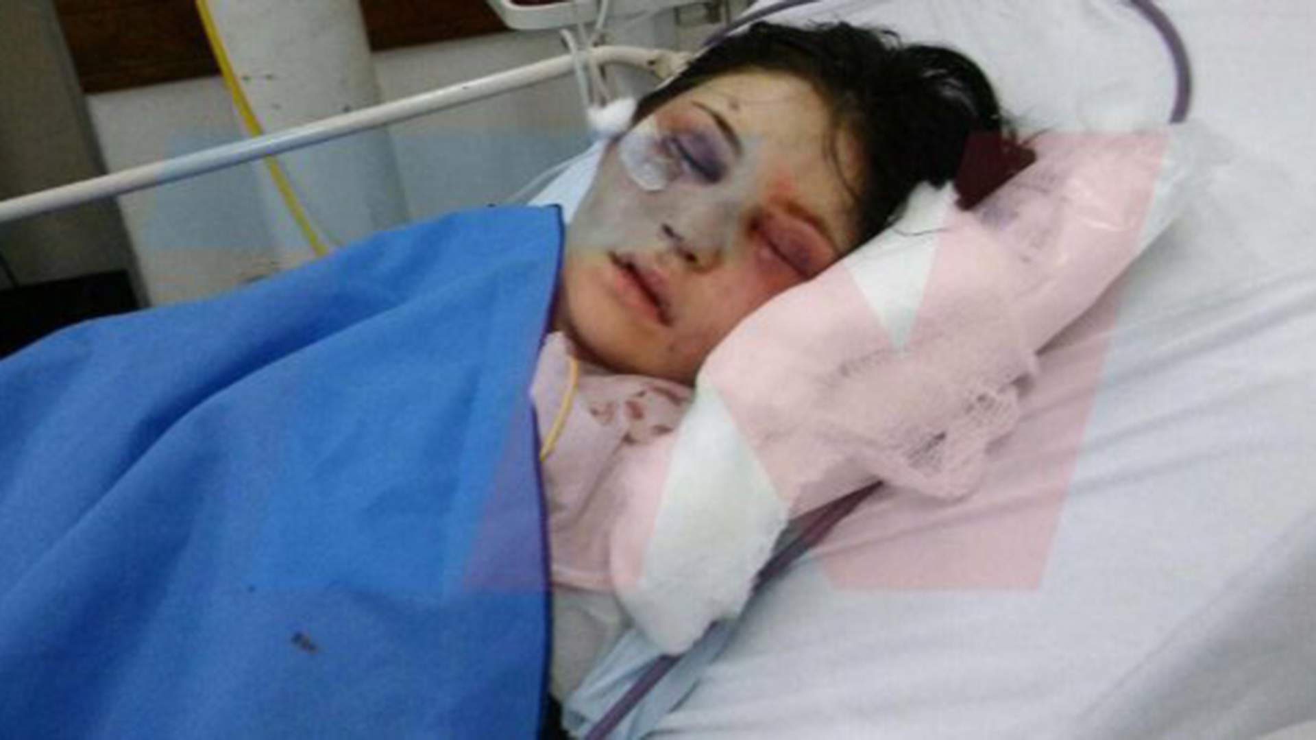 Belén Torres, la chica agredida que está internada